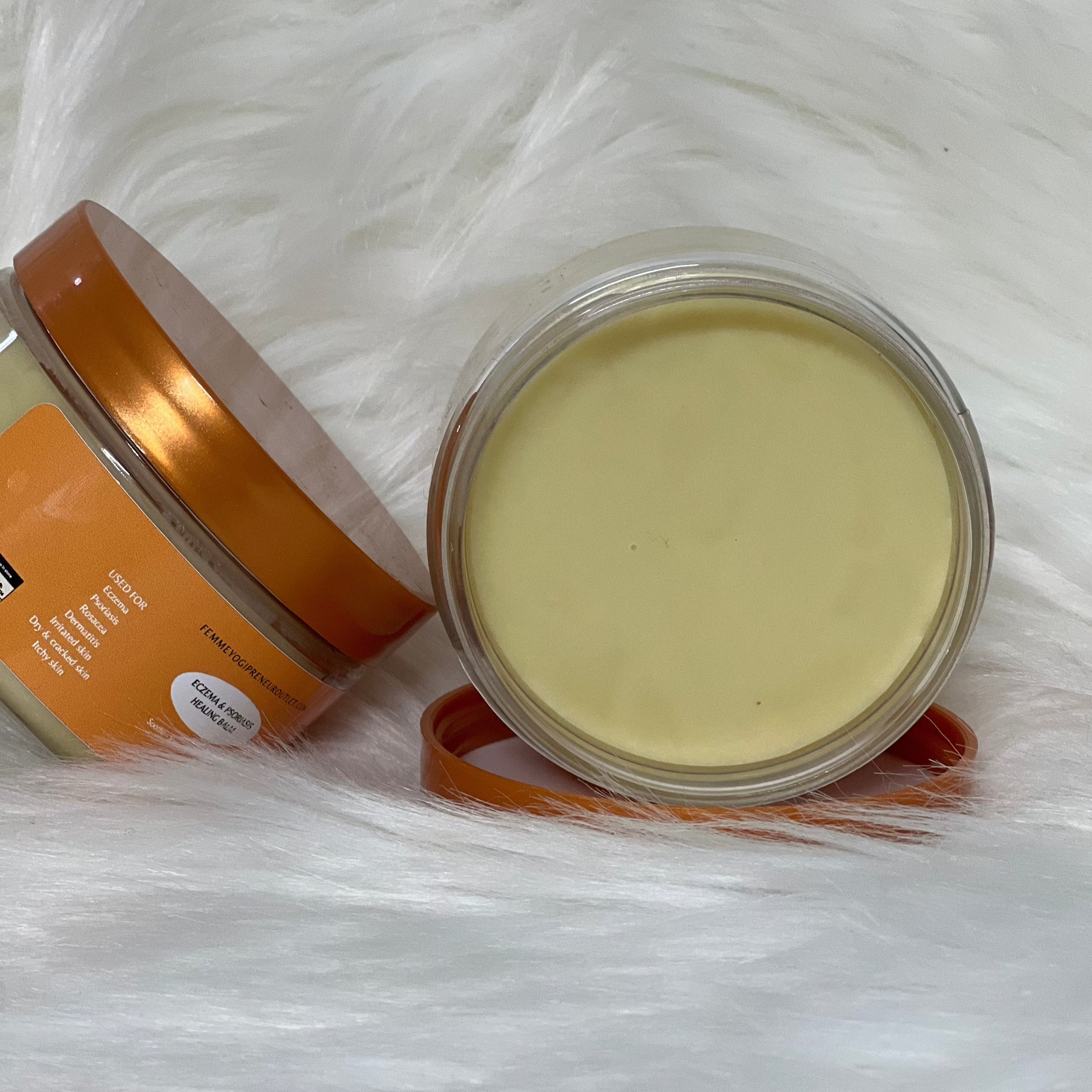 eczema and psoriasis healing balm